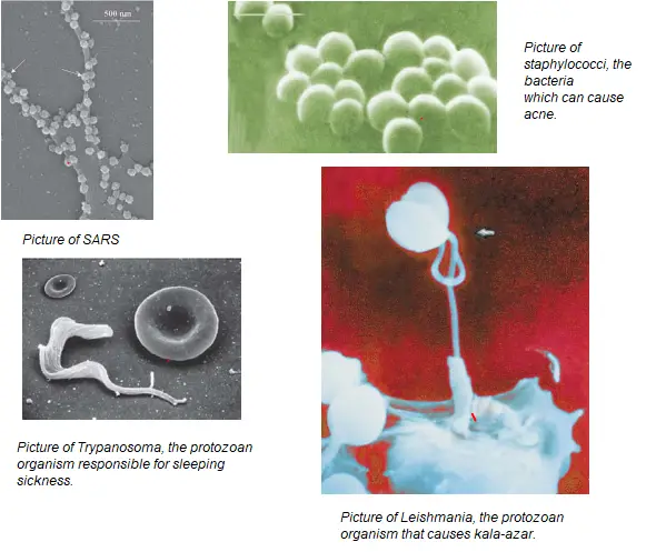 CBSE class 9 Science Why do we fall ill Notes